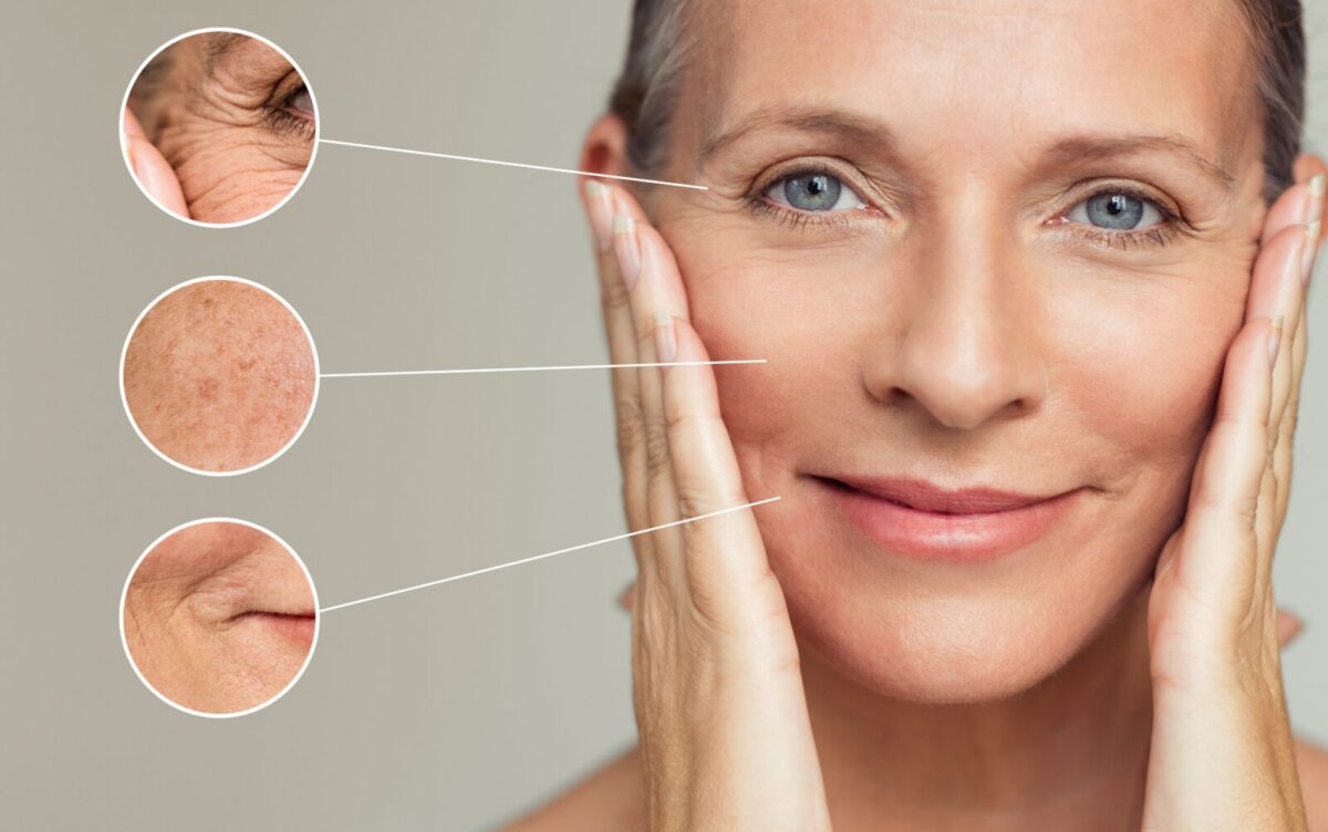 Anti-aging