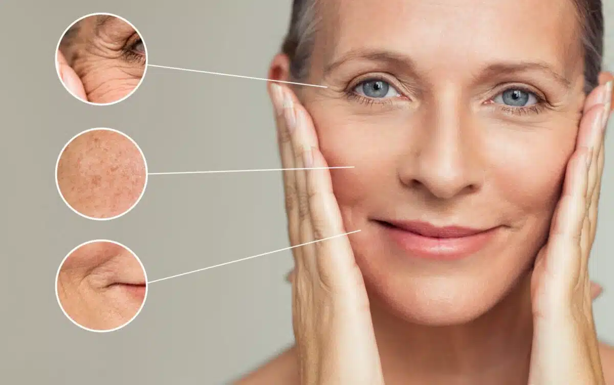 Anti-aging